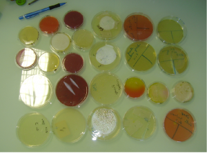 prélèvements microbiologiques sur des surfaces